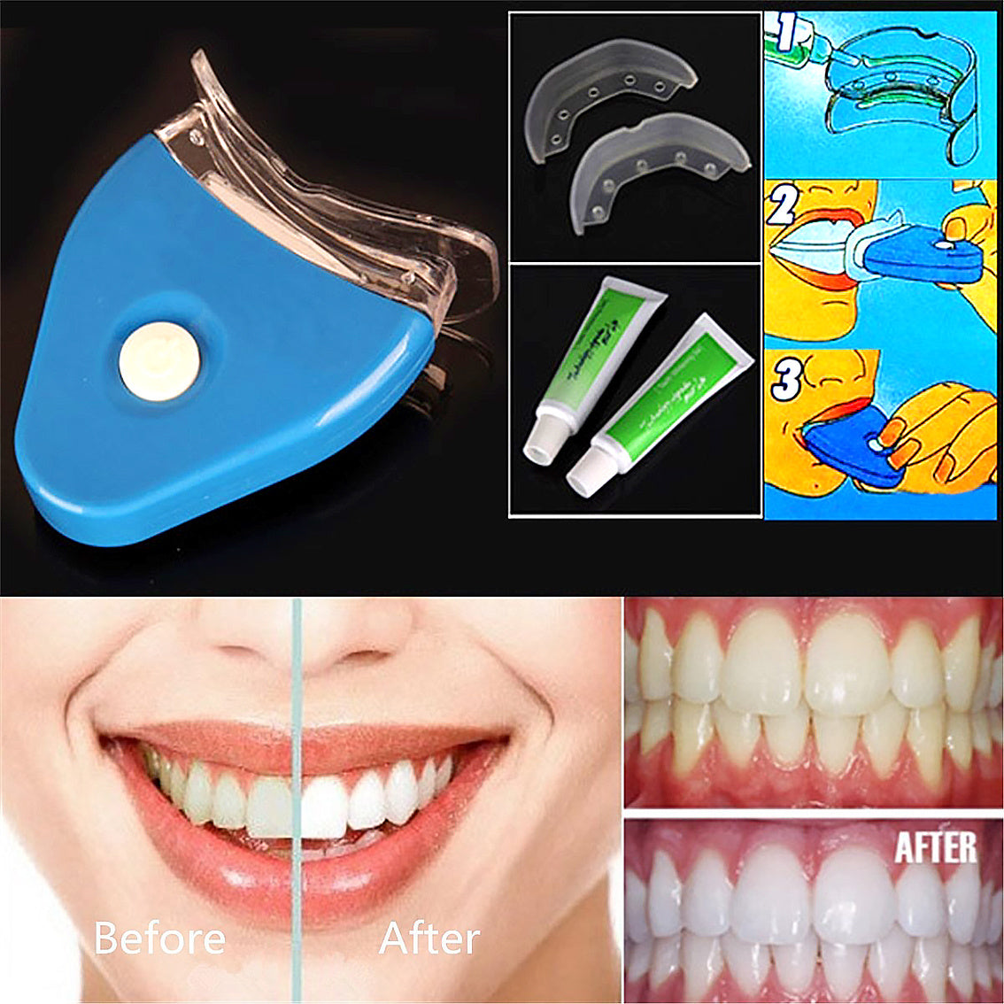 Oral Gel Teeth Tooth Whitening Whitener Dental Bleaching LED Oral Gel Teeth Tooth Whitening Whitener Dental Bleaching LED